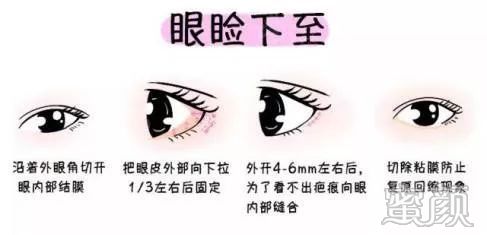https://img.miyanlife.com/mnt/timg/200208/14211aQ0-8.jpg