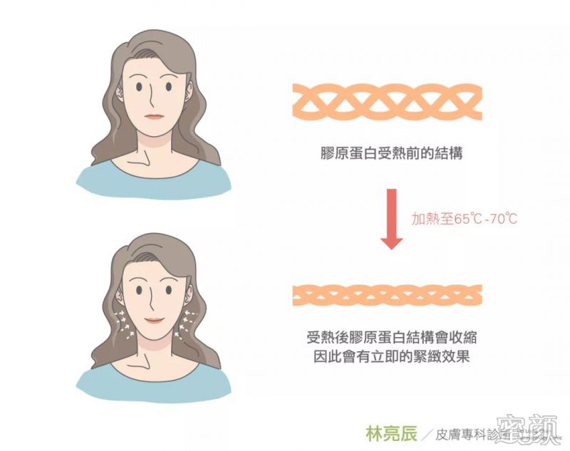 https://img.miyanlife.com/mnt/timg/200210/1334342V9-0.jpg
