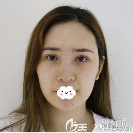 https://img.miyanlife.com/mnt/timg/200210/134011M63-0.jpg