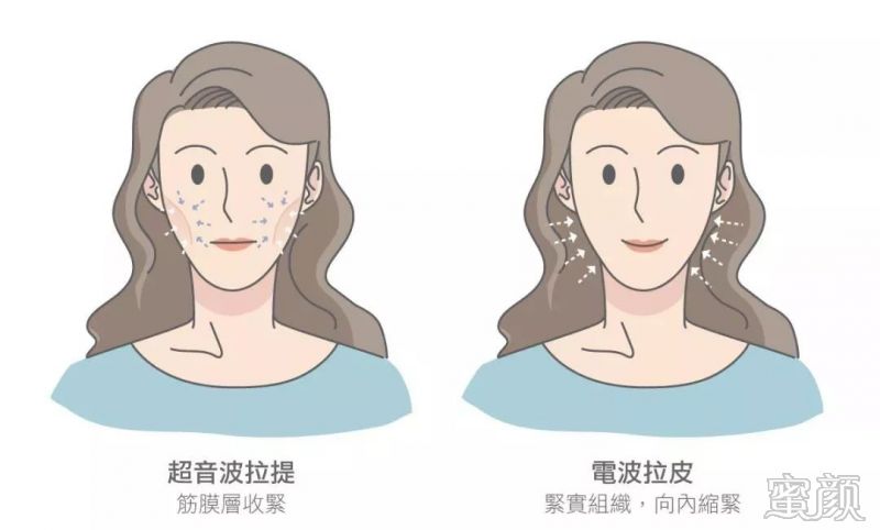 https://img.miyanlife.com/mnt/timg/200211/140423A61-3.jpg