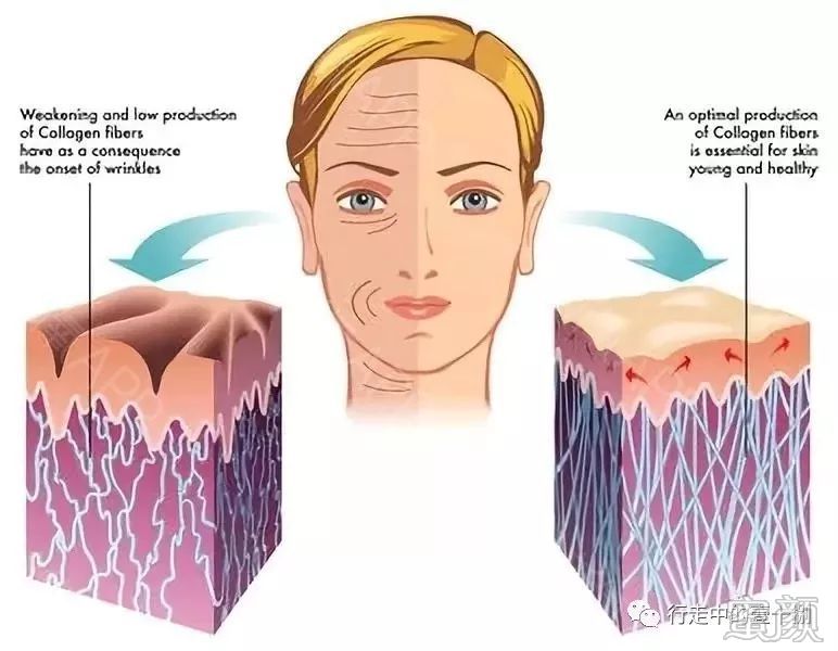 https://img.miyanlife.com/mnt/timg/200211/14233AP4-6.jpg