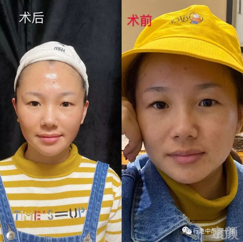 https://img.miyanlife.com/mnt/timg/200211/1423416218-13.jpg