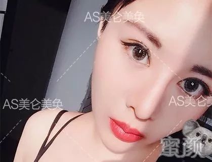 https://img.miyanlife.com/mnt/timg/200212/1404361141-6.jpg