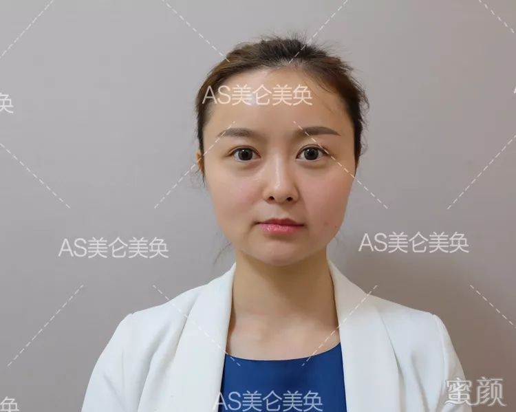 https://img.miyanlife.com/mnt/timg/200212/1404362317-7.jpg