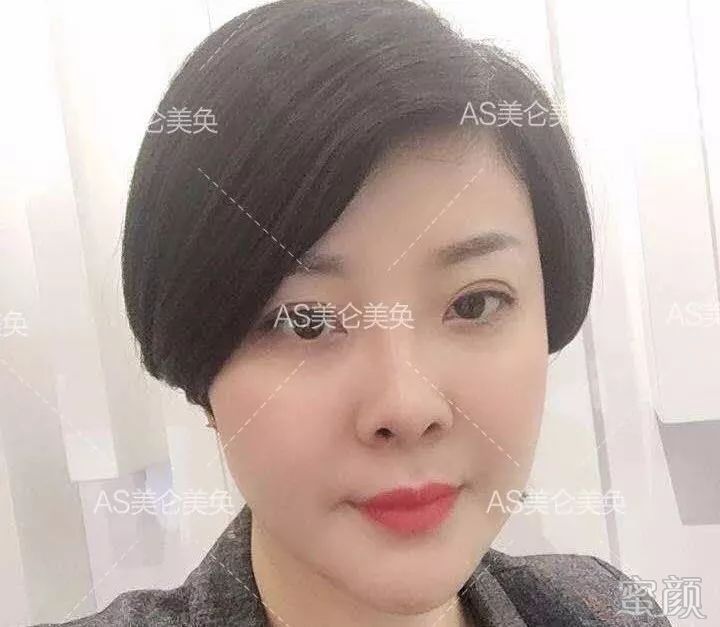 https://img.miyanlife.com/mnt/timg/200212/1404431495-12.jpg