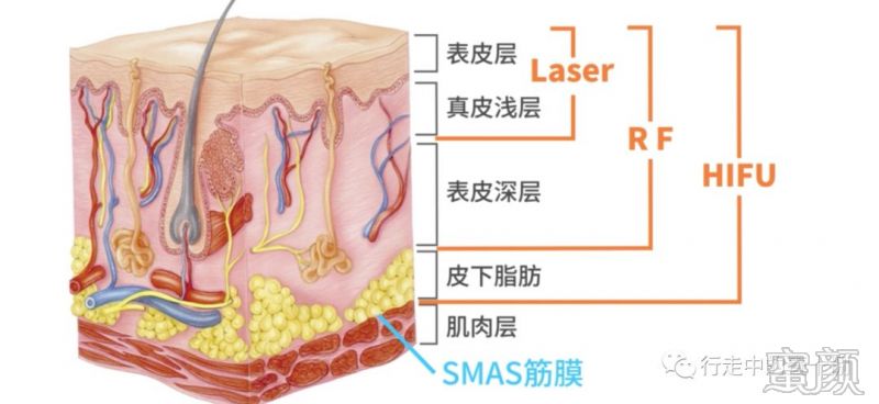 案例图片