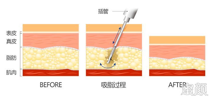 案例图片