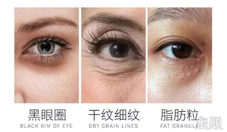 https://img.miyanlife.com/mnt/timg/200213/131P43V0-5.jpg