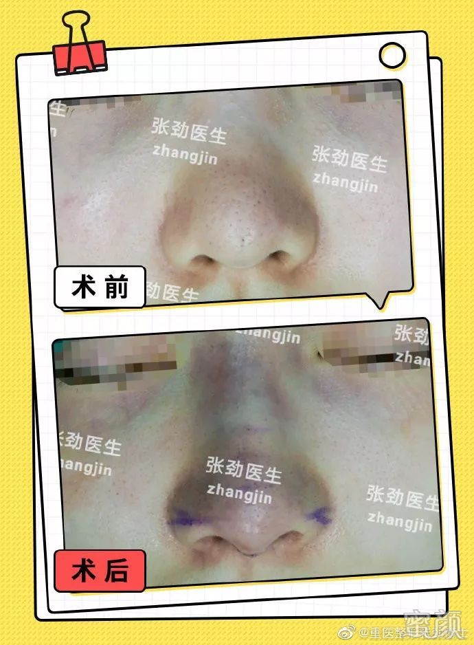 https://img.miyanlife.com/mnt/timg/200213/135R34E8-1.jpg