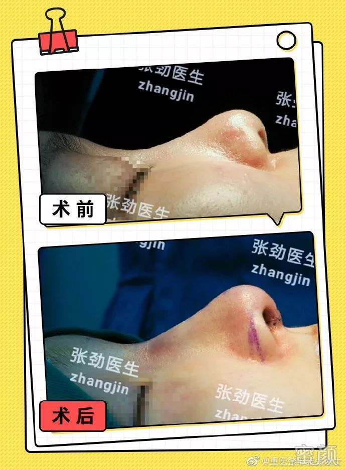 https://img.miyanlife.com/mnt/timg/200213/135R462T-2.jpg