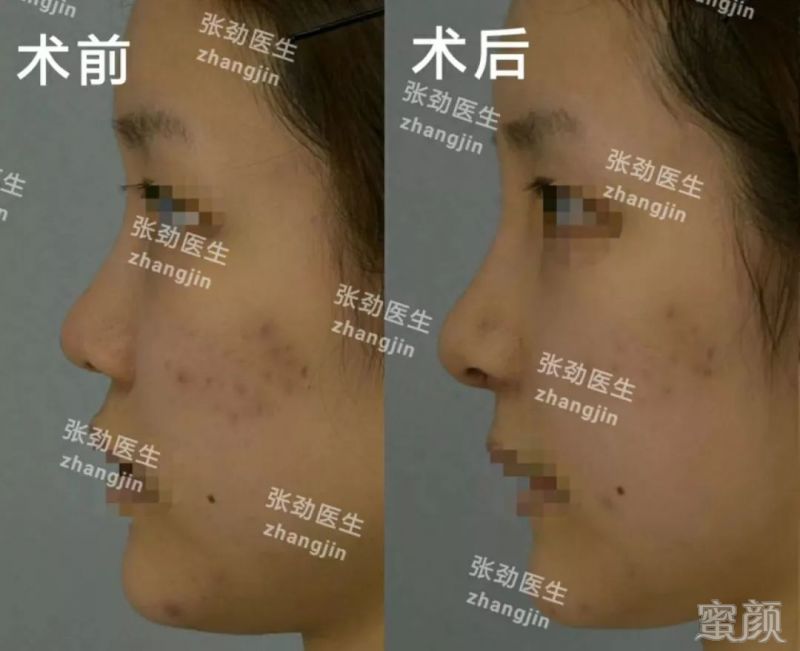 https://img.miyanlife.com/mnt/timg/200213/135RB132-4.jpg