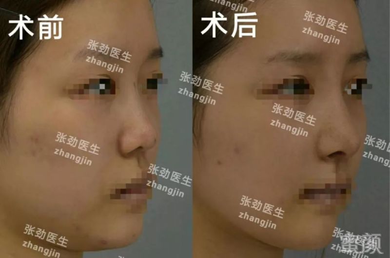https://img.miyanlife.com/mnt/timg/200213/135RKR1-5.jpg