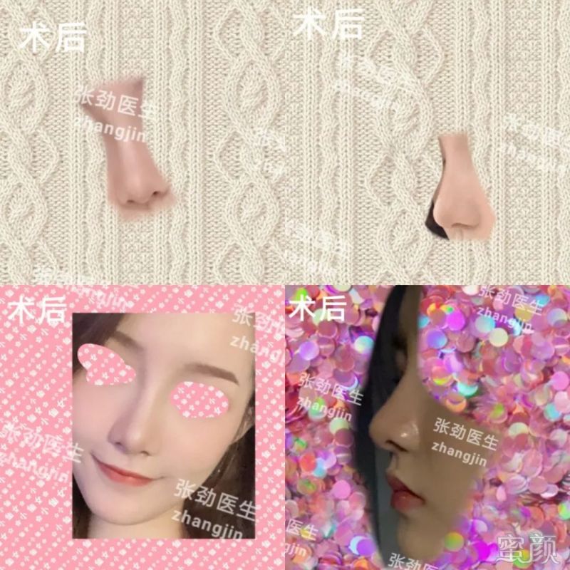 https://img.miyanlife.com/mnt/timg/200213/135RUN4-6.jpg