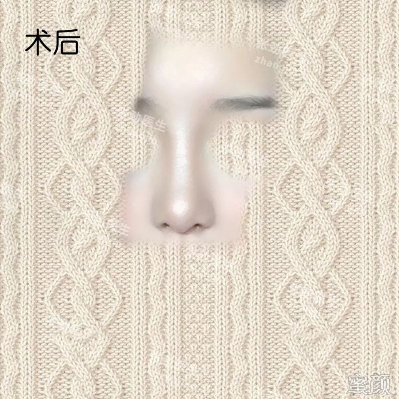 https://img.miyanlife.com/mnt/timg/200213/135S0O52-8.jpg