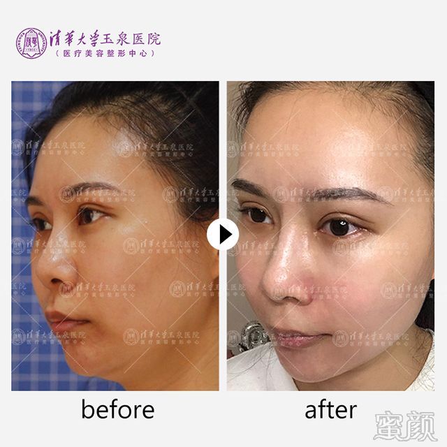 https://img.miyanlife.com/mnt/timg/200216/1649111532-8.jpg