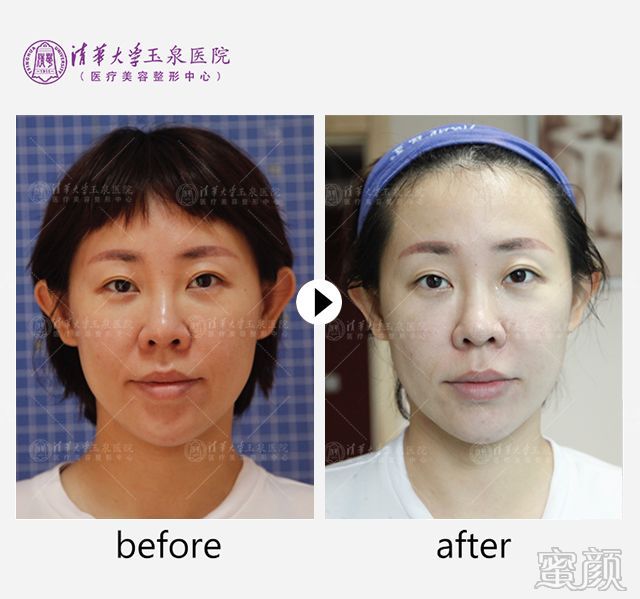 https://img.miyanlife.com/mnt/timg/200216/164Z95K1-5.jpg
