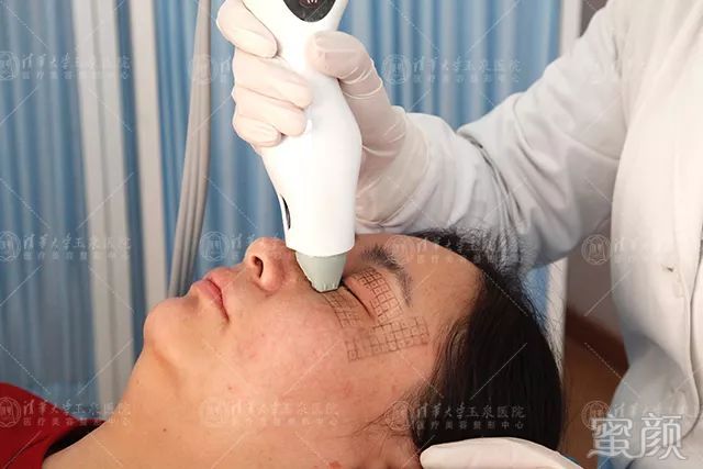https://img.miyanlife.com/mnt/timg/200216/164ZS547-4.jpg