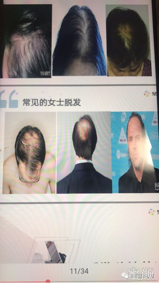 案例图片