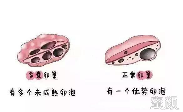 https://img.miyanlife.com/mnt/timg/200219/132A52X5-3.jpg