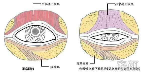 案例图片