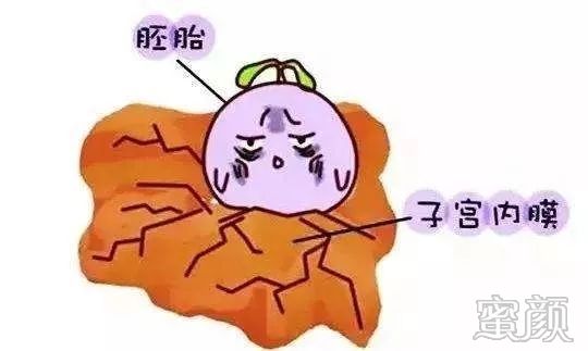 https://img.miyanlife.com/mnt/timg/200220/1352153648-4.jpg
