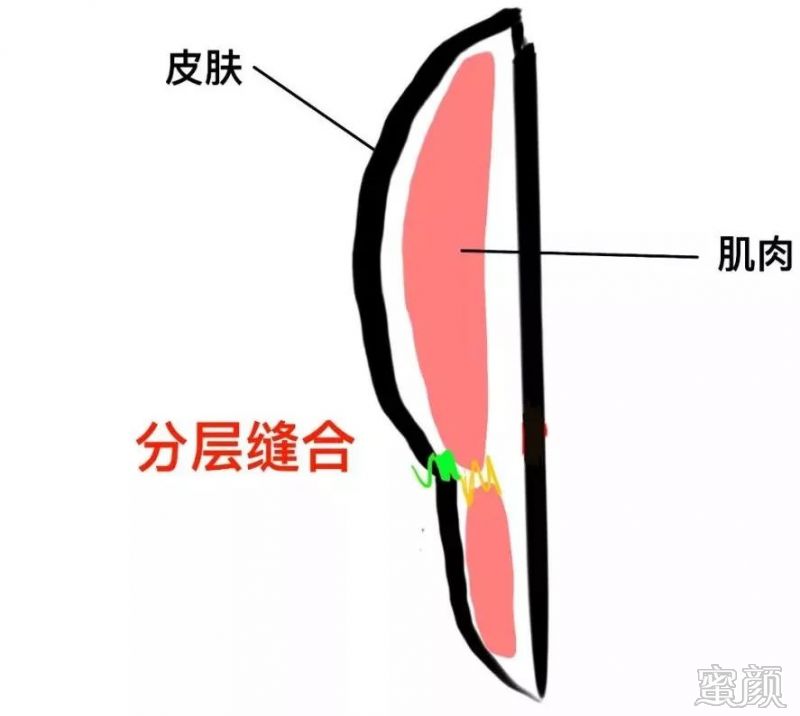 案例图片