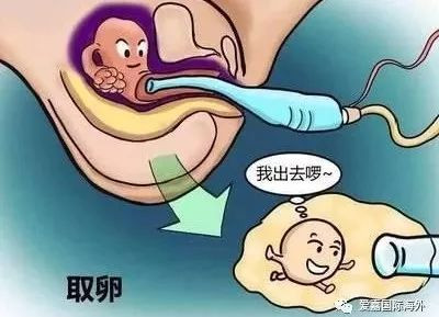 https://img.miyanlife.com/mnt/timg/200221/13000GR1-3.jpg
