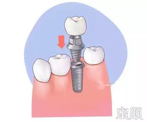 案例图片