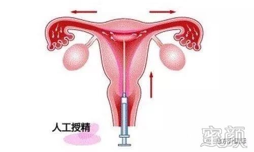 https://img.miyanlife.com/mnt/timg/200222/1330421324-13.jpg
