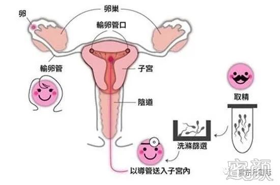 https://img.miyanlife.com/mnt/timg/200222/1330423623-14.jpg