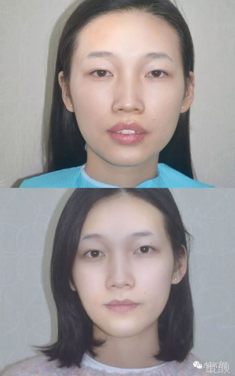 https://img.miyanlife.com/mnt/timg/200223/1332196137-0.jpg