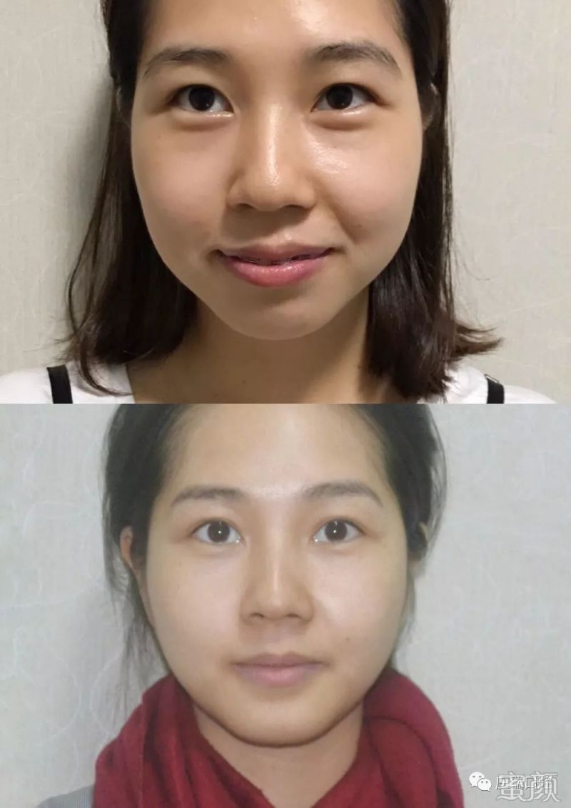 https://img.miyanlife.com/mnt/timg/200223/133220K38-2.jpg