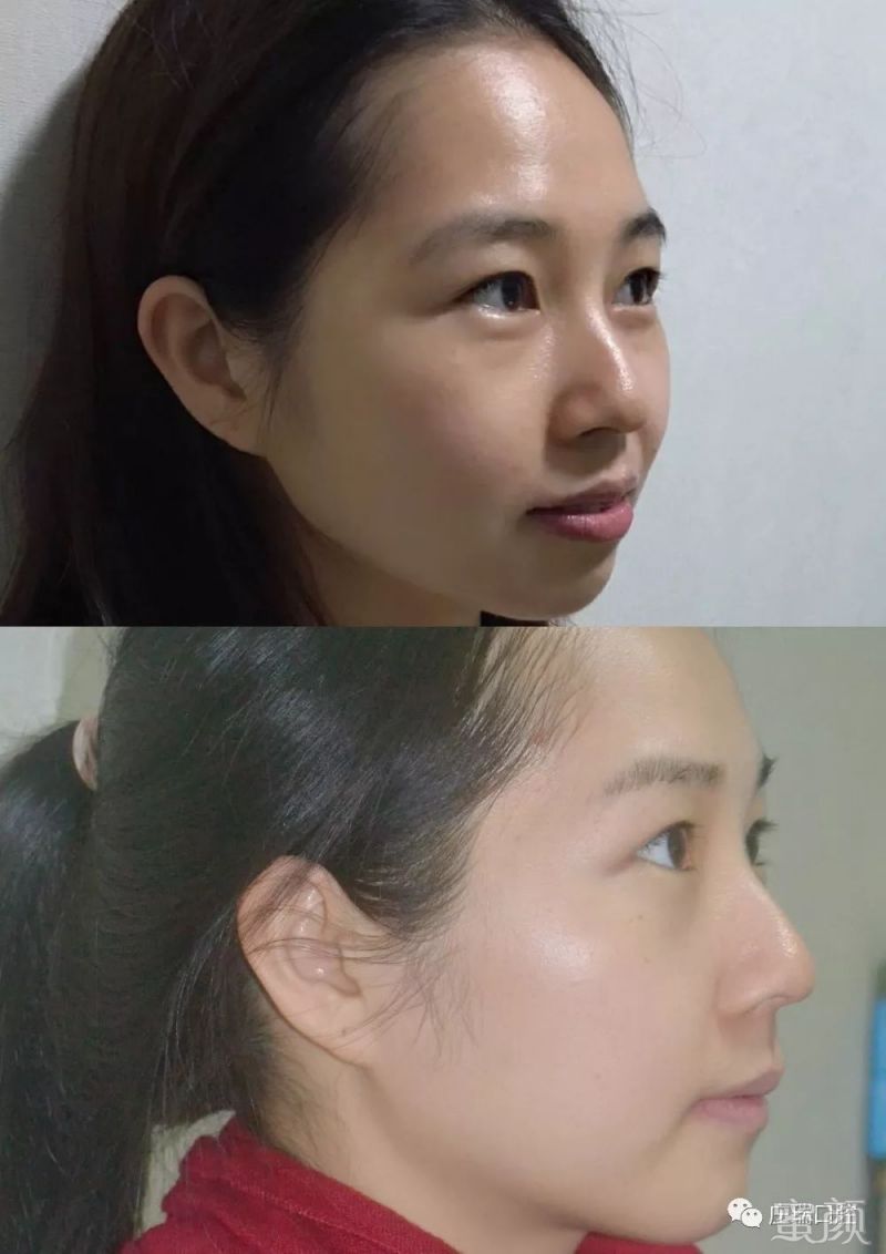 https://img.miyanlife.com/mnt/timg/200223/1332223I2-3.jpg