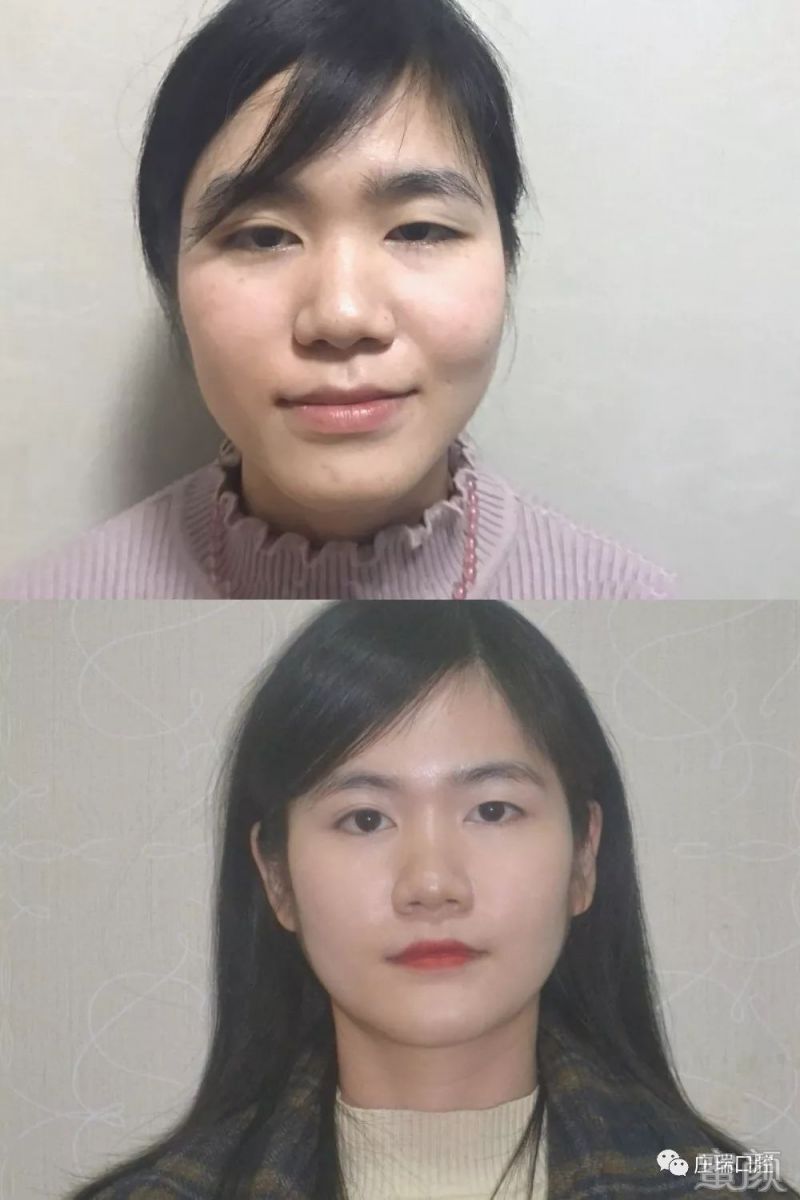 https://img.miyanlife.com/mnt/timg/200223/133224FO-4.jpg