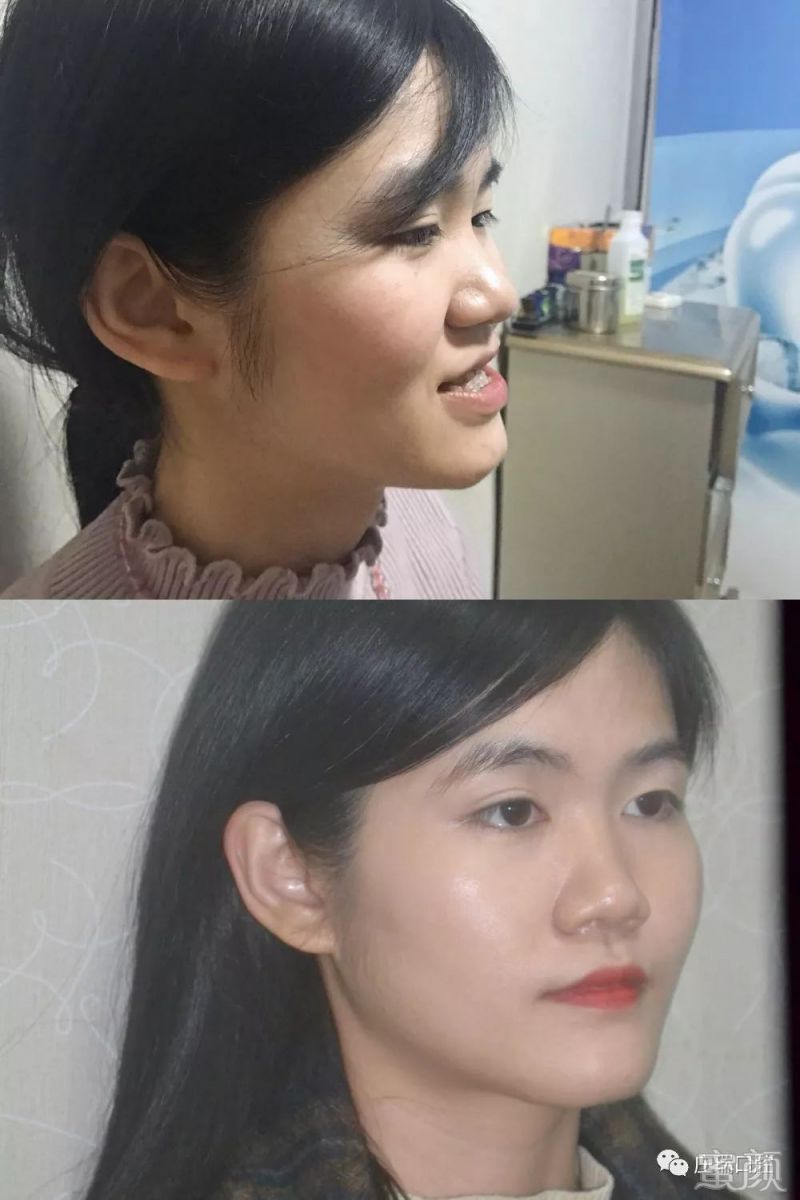 https://img.miyanlife.com/mnt/timg/200223/13322533O-5.jpg