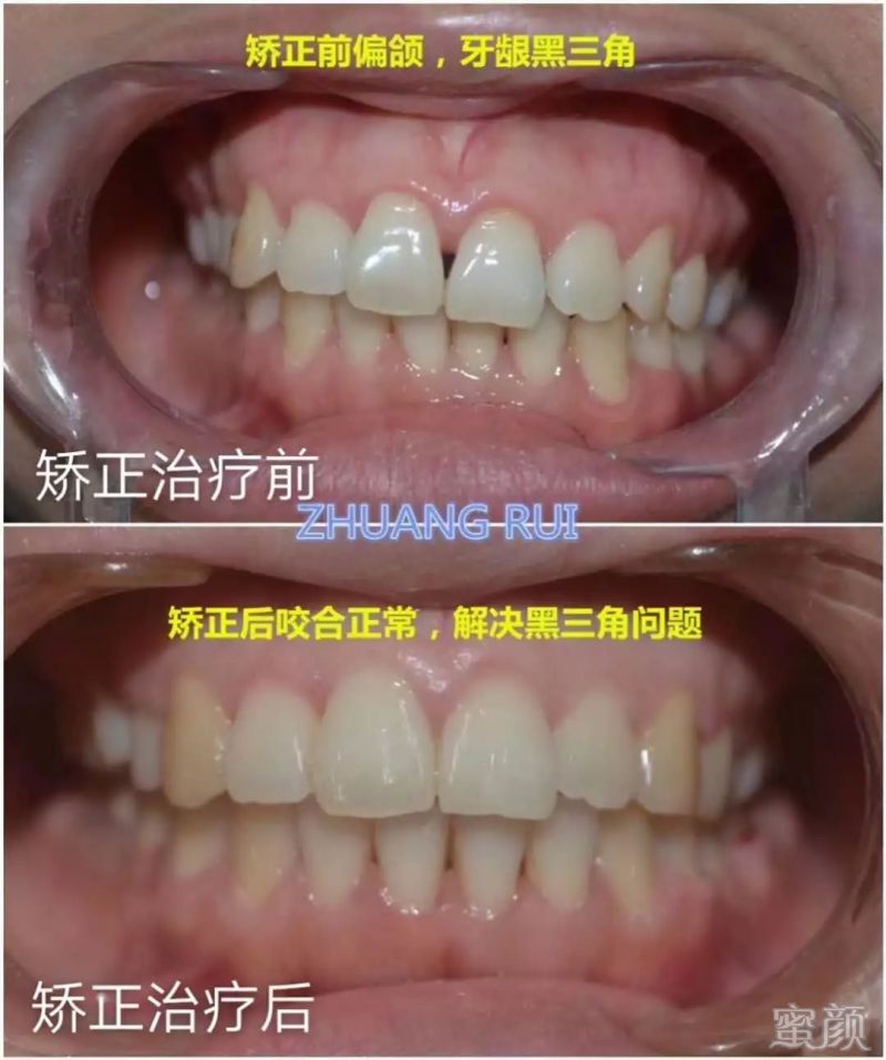 https://img.miyanlife.com/mnt/timg/200223/133229E02-9.jpg