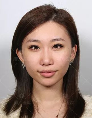 https://img.miyanlife.com/mnt/timg/200225/13514V507-12.jpg