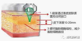 https://img.miyanlife.com/mnt/timg/200225/14191T606-5.jpg
