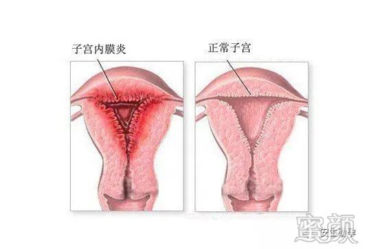 https://img.miyanlife.com/mnt/timg/200226/1235413532-0.jpg
