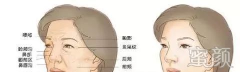https://img.miyanlife.com/mnt/timg/200226/130R1J52-1.jpg