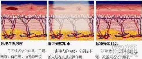 案例图片