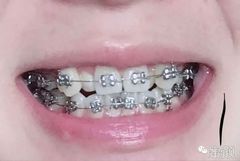 https://img.miyanlife.com/mnt/timg/200227/13221R332-4.jpg