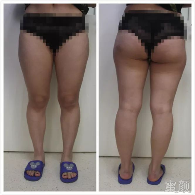 https://img.miyanlife.com/mnt/timg/200227/1434401619-4.jpg
