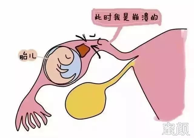 https://img.miyanlife.com/mnt/timg/200228/1224513b8-1.jpg