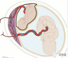 https://img.miyanlife.com/mnt/timg/200228/1250502R1-0.jpg