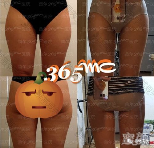 https://img.miyanlife.com/mnt/timg/200228/130420F91-3.jpg