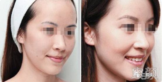 https://img.miyanlife.com/mnt/timg/200228/132P92913-4.jpg