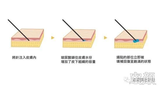 https://img.miyanlife.com/mnt/timg/200228/133S32352-0.jpg