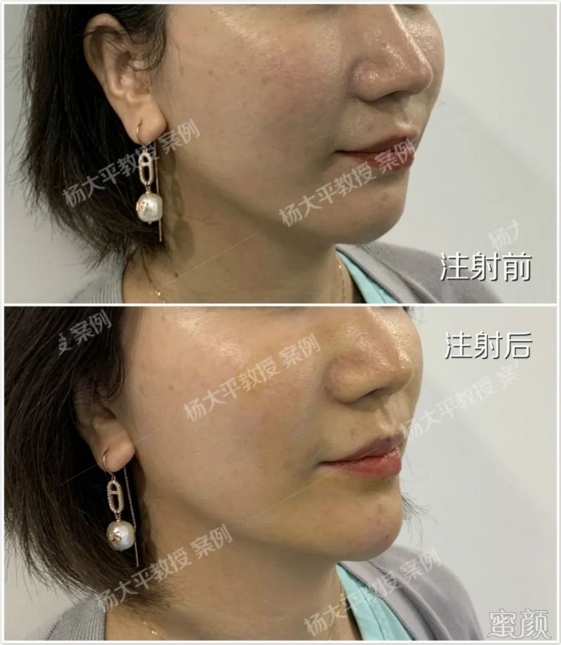 https://img.miyanlife.com/mnt/timg/200229/134IT1O-1.jpg