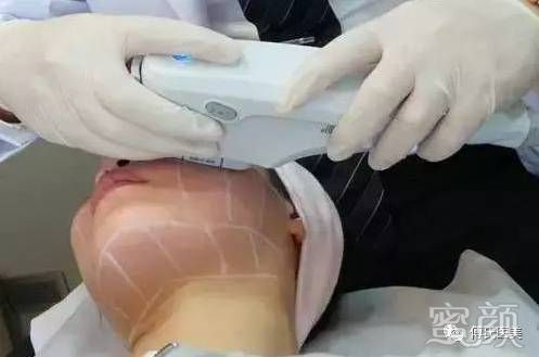 https://img.miyanlife.com/mnt/timg/200229/1425215528-4.jpg